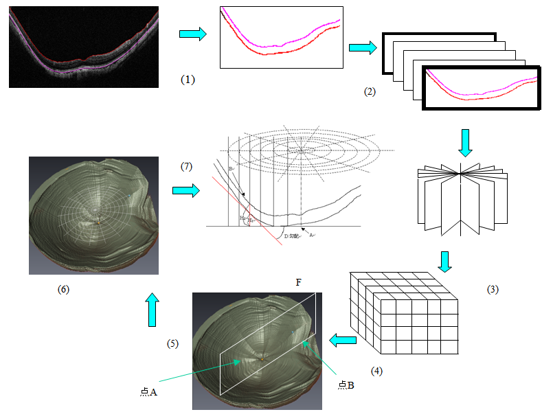 Radial_OCT画像の3D再構築と形状測定